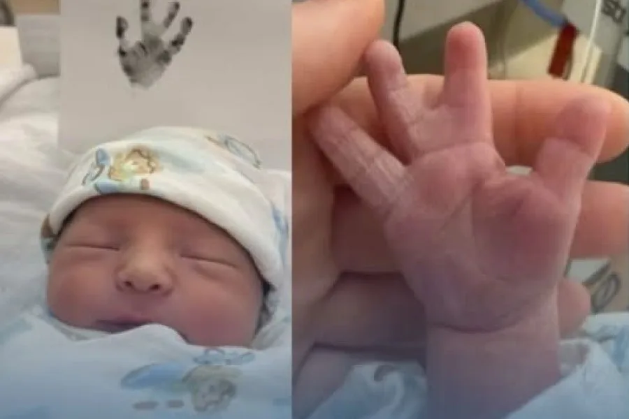 Nació un bebé con una aleta de la suerte y su tierna historia conmovió a miles de personas en las redes