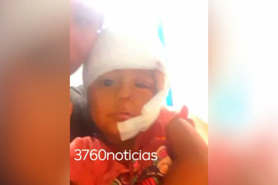 Una nena de tres años sufrió graves heridas en la cabeza tras ser atacada por un pitbull en Añatuya