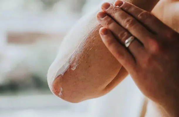 ANMAT prohibió una serie de cremas terapéuticas y productos para piletas: de cuáles se trata