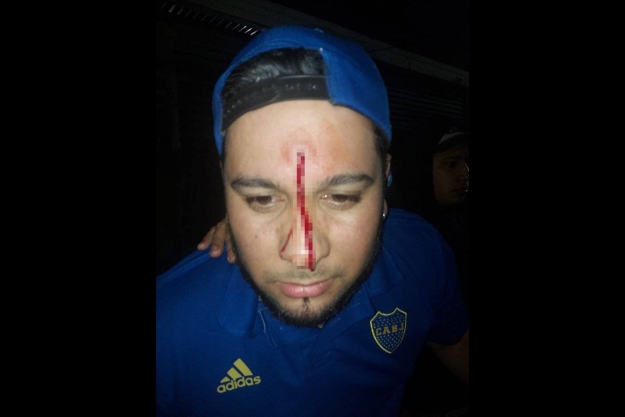 Cantaba cumbia en la calle y un vecino harto le pegó un tiro en la frente con un rifle