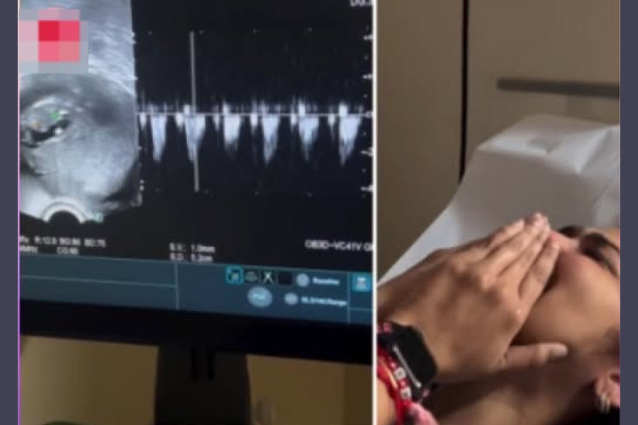 Una mujer de 45 años creyó que estaba entrando en la menopausia pero resultó estar embarazada de 11 semanas