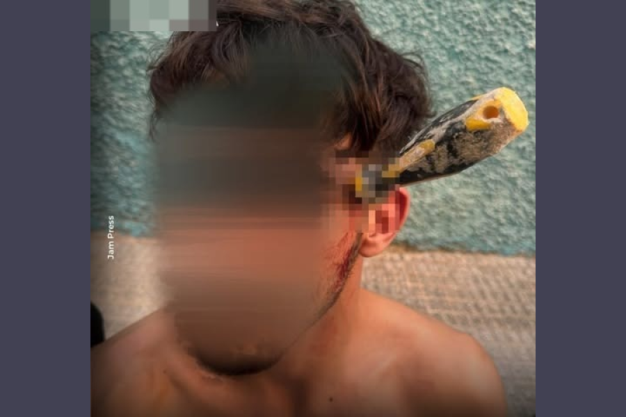 Una disputa por dinero terminó con un destornillador clavado en la sien de un joven de 25 años